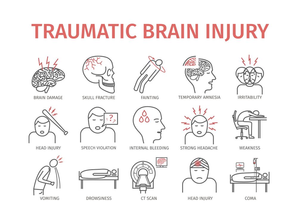 What Are the Different Types of Head Injuries?