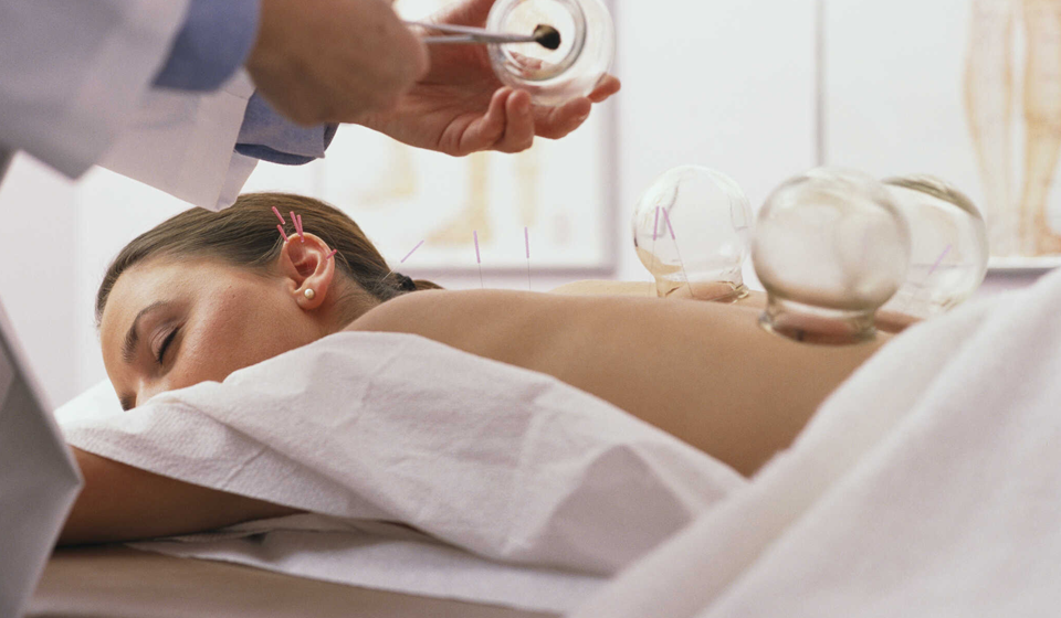 Cupping Treatment in Surrey: Trusted Massage Therapy for Pain Relief and Wellness